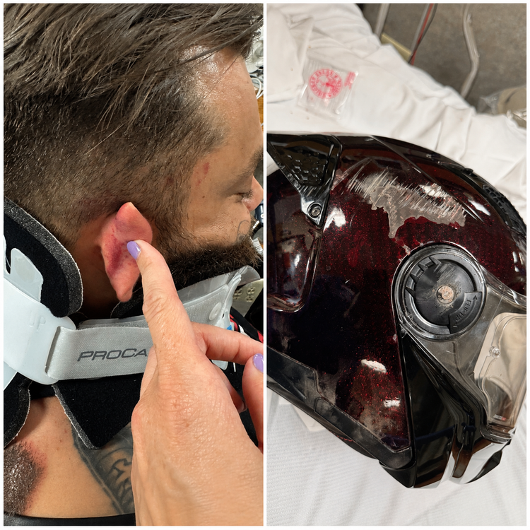 C6 PRO Carbon Modular vs Accident